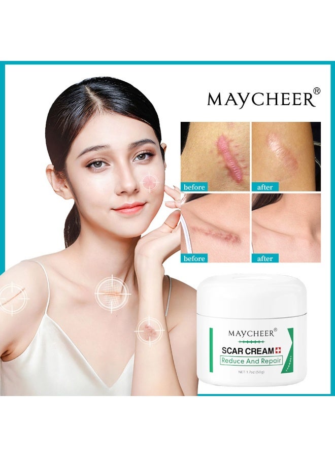 MAYCHEER 3PCS Scar Repair Cream 50g | Specially for Post-operative Burn Scars | Scar Fading and Repair Cream | Skin Ointment, Unisex - Image 2